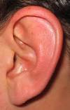 tinnitus treatments