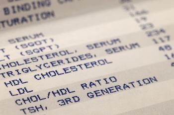 Cholesterol Link To Alzheimer's