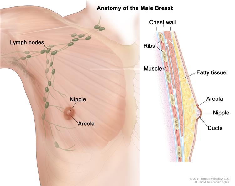 male breast cancer