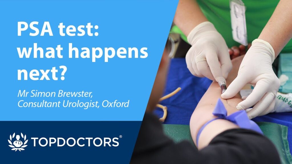 Prostate cancer and PSA test results Health Care For Men