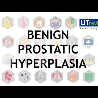 Benign Prostatic Hyperplasia