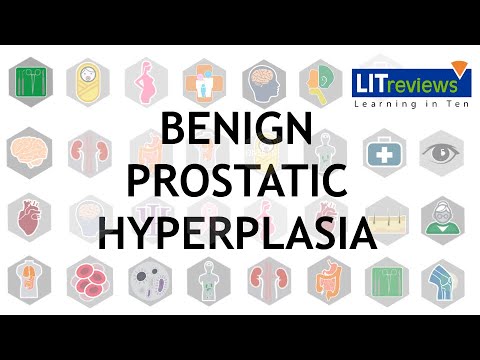 Benign Prostatic Hyperplasia